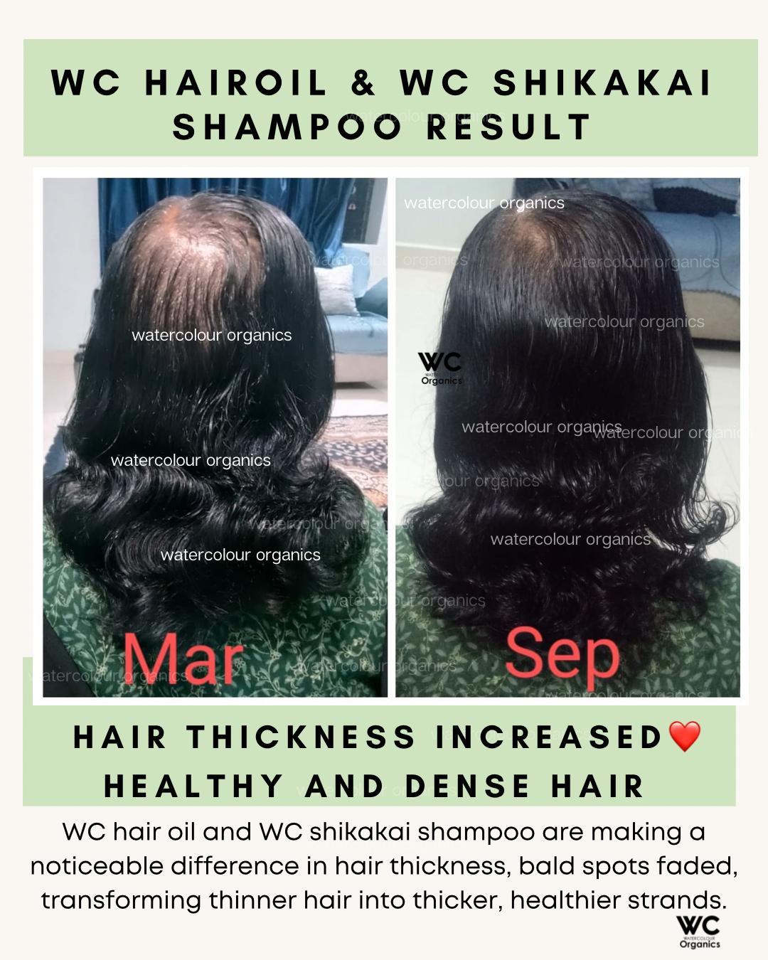WC Hair Thickness Combo (Hair Oil & Shikakai Shampoo)