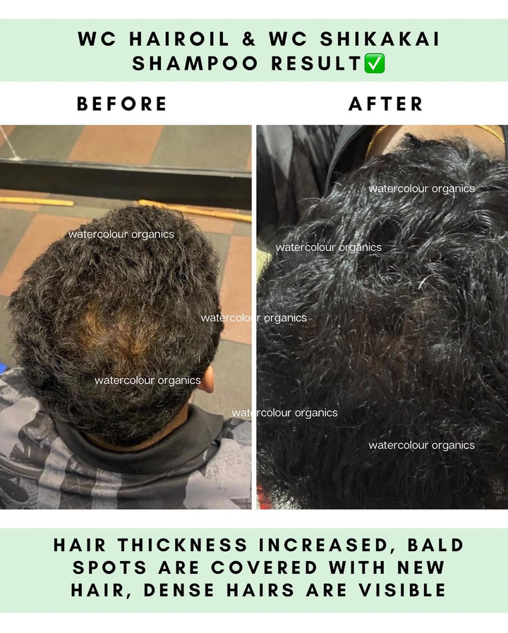 WC Hair Thickness Combo (Hair Oil & Shikakai Shampoo)